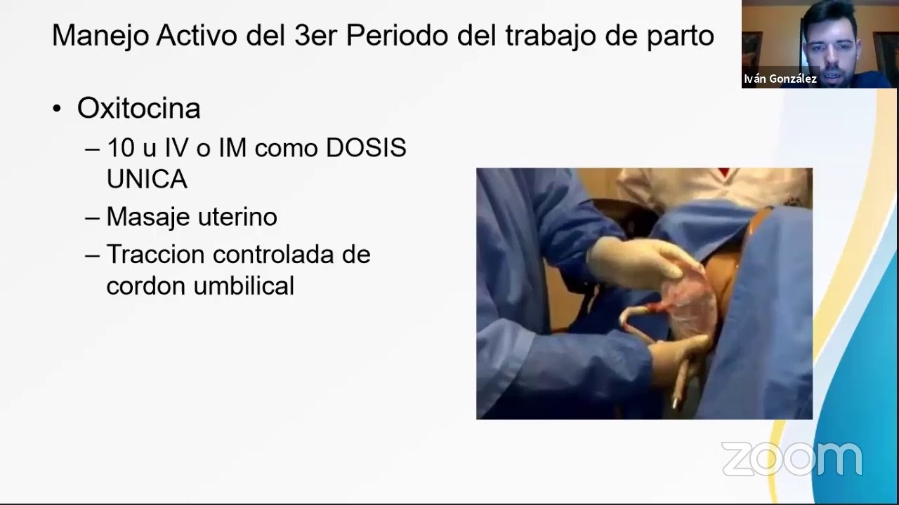 Trabajo de parto ENARM 2020 - Dr. Iván Cortés