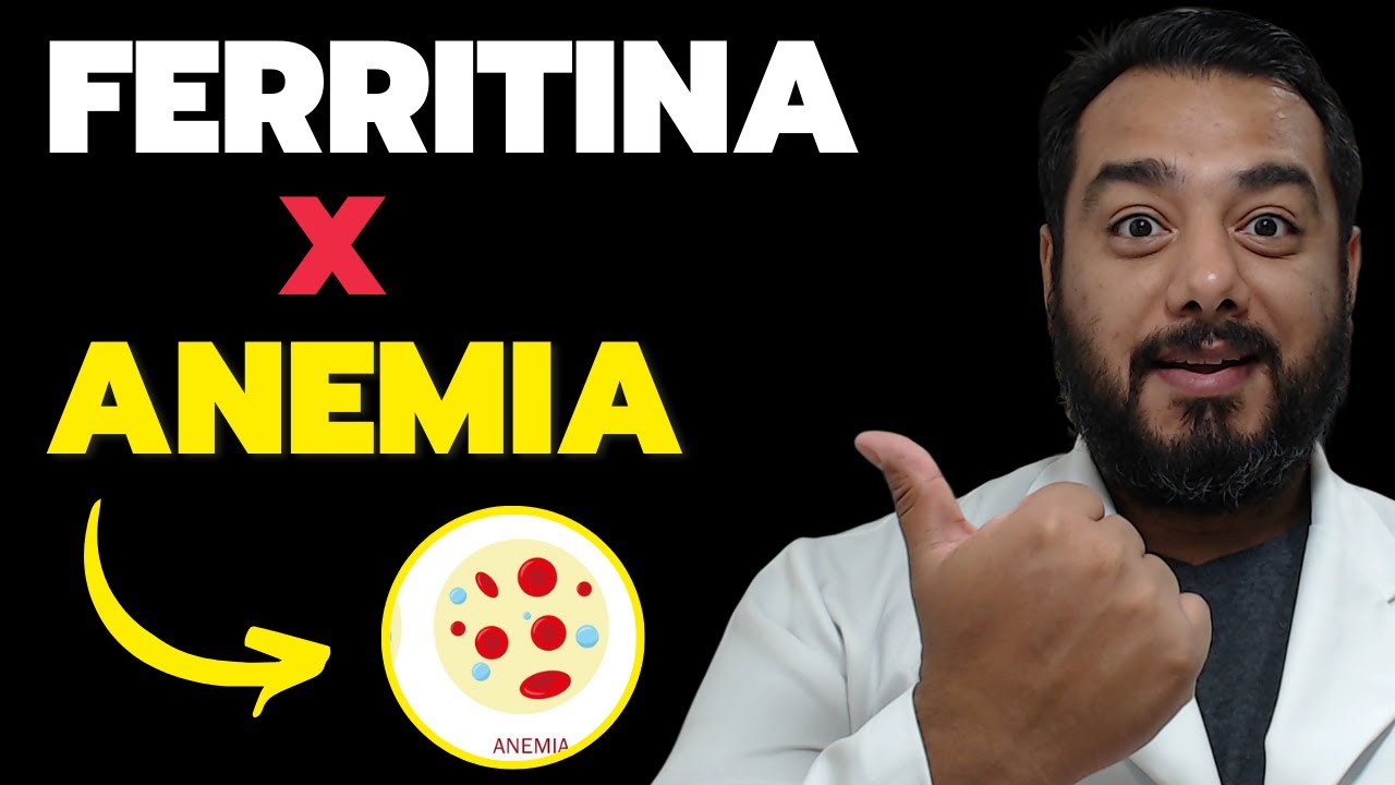 Qual valor de ferritina pode ser considerado anemia? | Prof. Dr. Victor Proença - IBAP Cursos