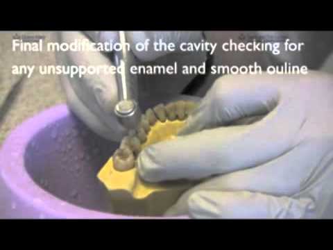 PRD approximal posterior amalgam part 1 of 2