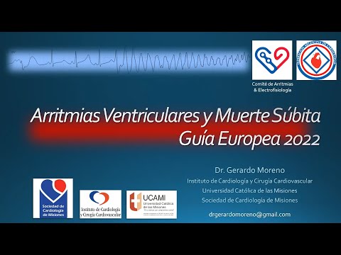 Webinar FAC - Arritmias ventriculares y muerte súbita. Guía Europea 2022