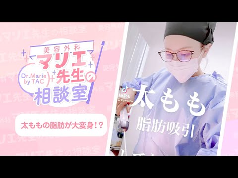 【太もものいらない脂肪を使う?!】まあるい可愛いおでこの作り方♡