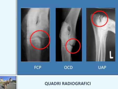 Podolsk MRI dellarticolazione della spalla Ruolo nel rafforzamento delle articolazioni