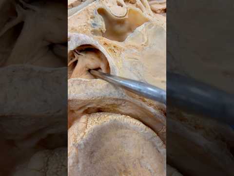 Look At This Tube Inside Your Throat!