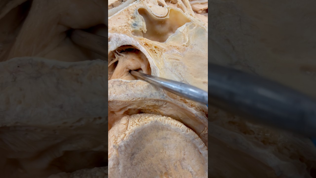 Look At This Tube Inside Your Throat!