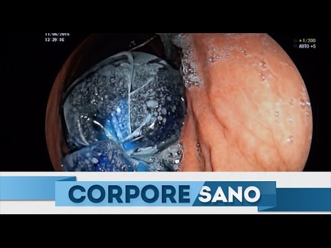 ¿Cuántos kilos se pierden después de una colonoscopia? Descubre la verdad. | Actualizado septiembre 2023