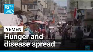 Yemen fighting deepens hunger emergency as children face severe malnutrition