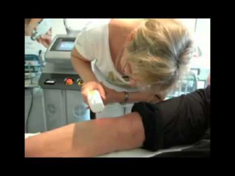 haarentfernung heusweiler