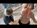 HUGE Knots Popped Out Of His Back Chiro CRUNCHES Strong Man S Back For Tension Relief