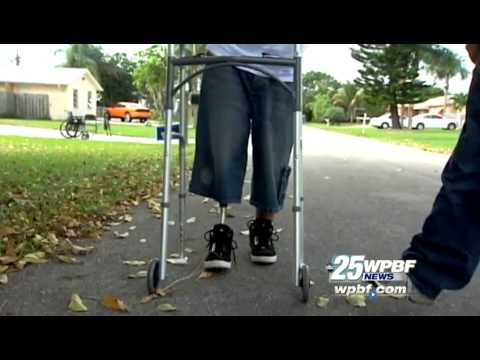 Angel Soto learning to walk again with new leg