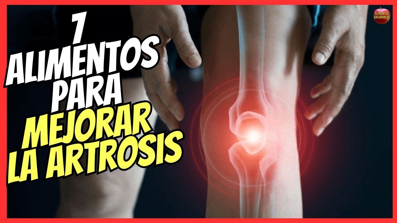 🔴 7 ALIMENTOS QUE AYUDAN PARA MEJORAR LA ARTROSIS 🔴