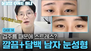 남자 애매한 눈이 고민이라면?🤔  | 눈성형 ONE 하니