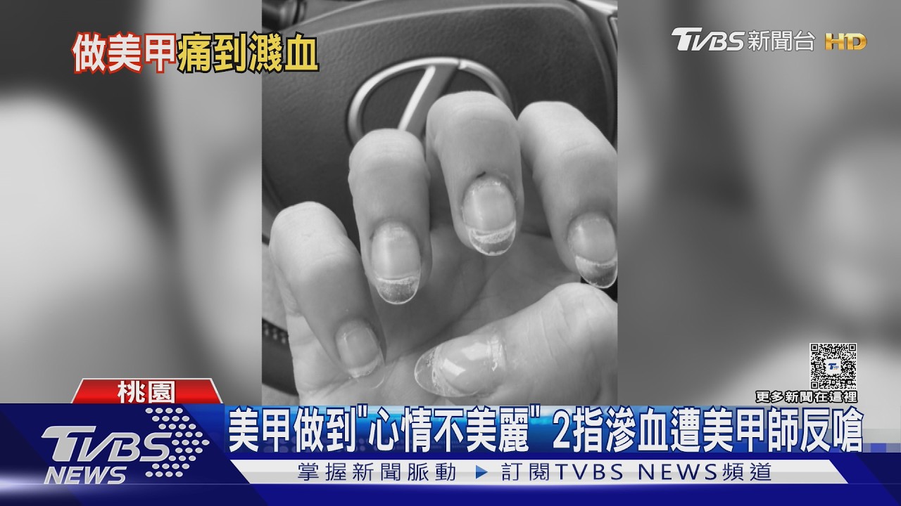 桃園女做美甲「手指滲血」!反映後被嗆 美甲師:不能給負評