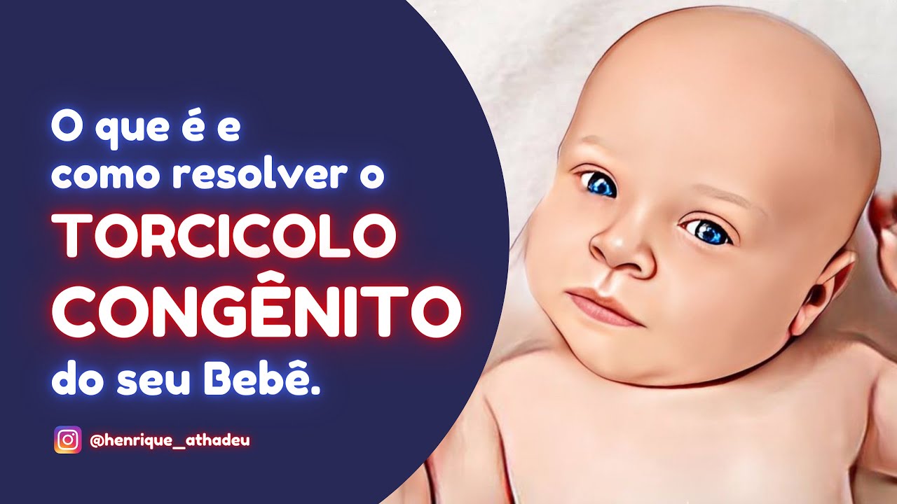 Torcicolo Congênito! O que é? O que pode causar? COMO RESOLVER? #torcicolo #maternidade #bebê #amor
