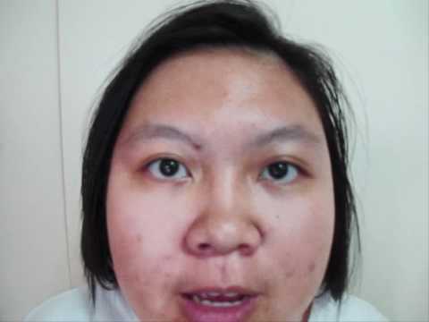 Avvisi mezzi da posti di pigmentary su una faccia La decolorazione di crema per il viso nel letual
