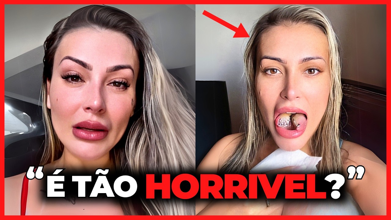 35 FAMOSOS QUE ARRUINARAM A CARREIRA COM CIRURGIAS PLÁSTICAS IRRECONHECÍVEIS... 😱