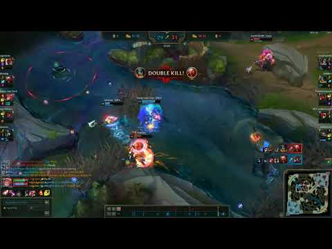 Zoe Supports the Support