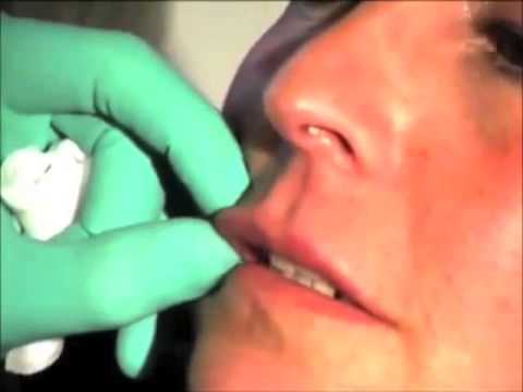 Massaggio in osteocondrosi della regione lombare Ginocchio prezzo ecografia articolare