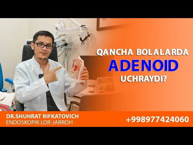 Qancha bolalarda Adenoid uchraydi