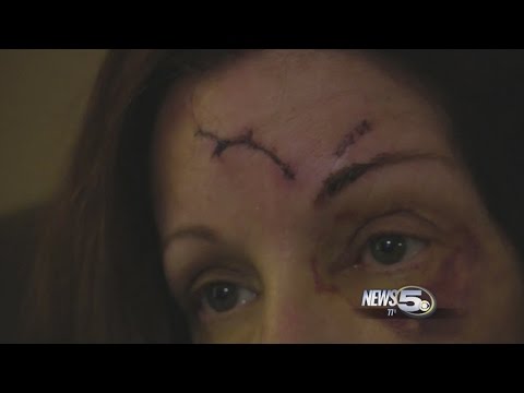 ONLY ON 5: Vicious Attack With Claw Hammer Caught On Camera