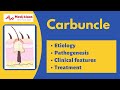Carbuncle The Cluster Of Boils General Surgery Mediklaas