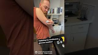 Download lagu Continuous glucose monitoring makes it easier to track your blood sugar levels! mp3