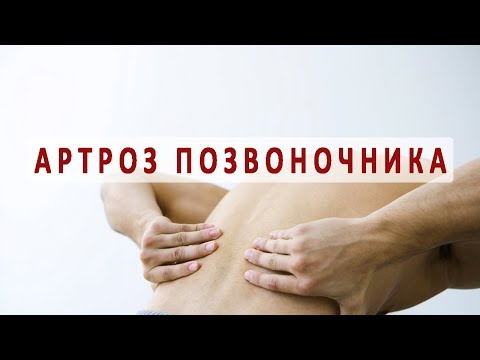 Восстанавливается ли хрящ в коленном суставе Анестезия при кесаревом сечении болит спина