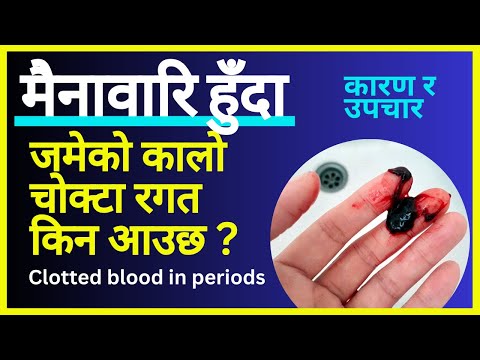 मैनावारि हुँदा जमेको कालो चोक्टा रगत किन आउछ ? Clotted blood during periods || Mero Health
