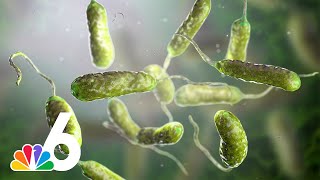 Is flesh-eating bacteria on the rise? Everything you need to know about necrotizing fasciitis