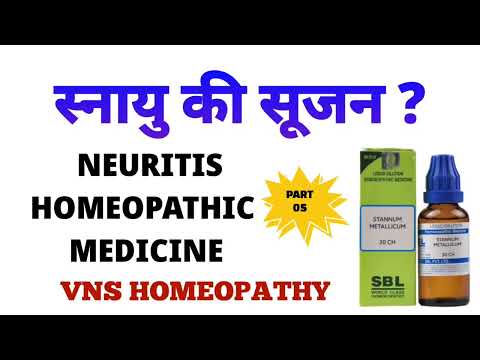 स्नायु दर्द का इलाज | neuritis treatment | neuritis homeopathic medicine | stannum met homeopathy