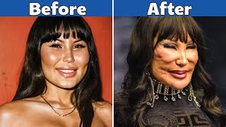 40 Celebrities Before and After Plastic Surgery