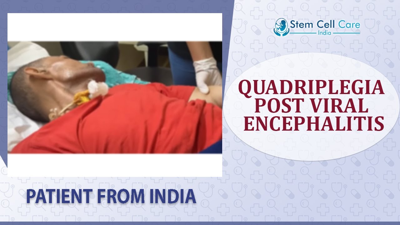 The Patient From Delhi Physiotherapy Session For Quadriplegia Post Viral Encephalitis