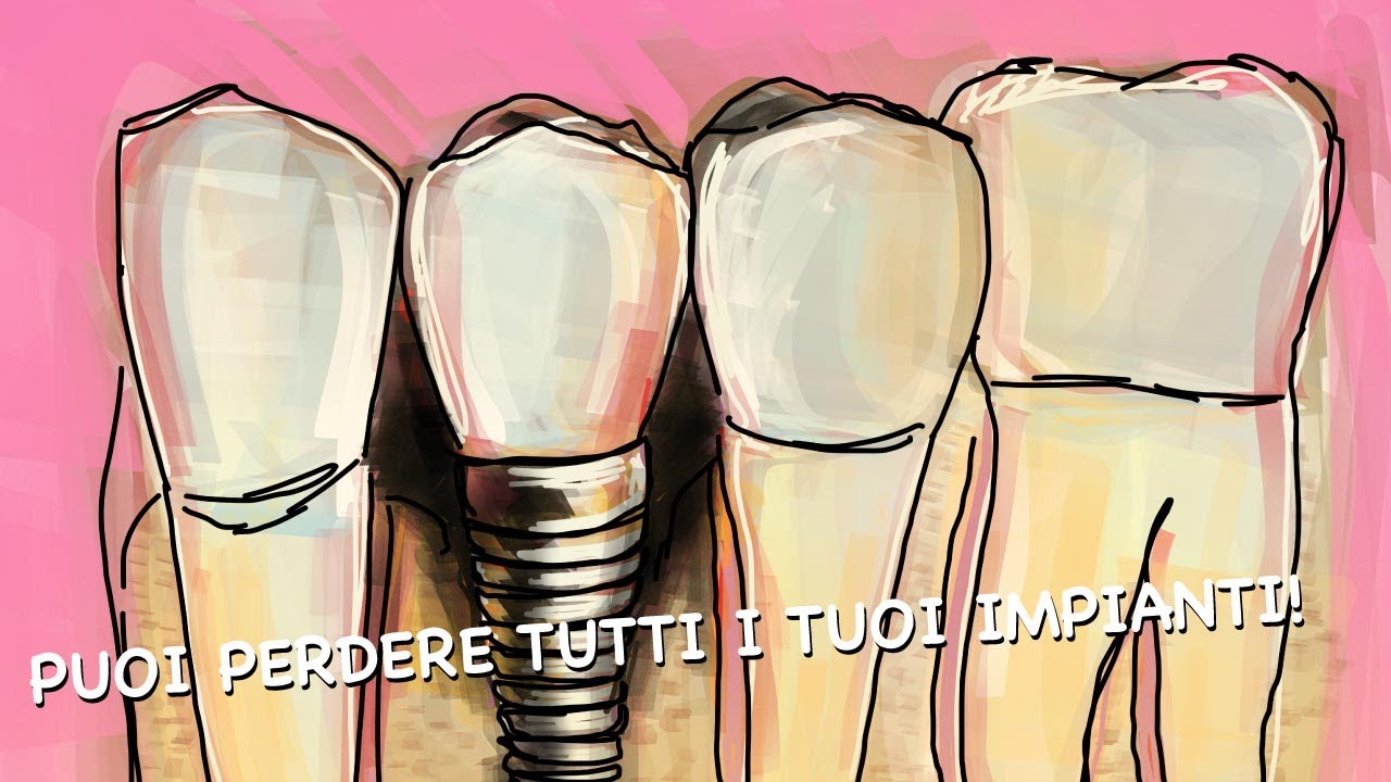 Gianluigi Bittante-103