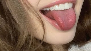 experimental complete teeth reconstruction 💉🦷  ⊹ ࣪ ˖ ୨୧ 1X INSTANT RESULTS