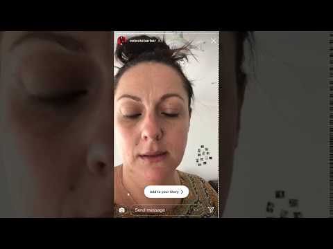 キープカルメ、セレステ・バーバーが語る擦り傷。 (Keep Calmmé, Celeste Barber talks chafing.)