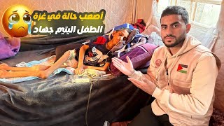شاهدو معاناه الام والطفل اليتيم جهاد أصيب شلل كامل اثر اصابته الخطيرة🥹🫂
