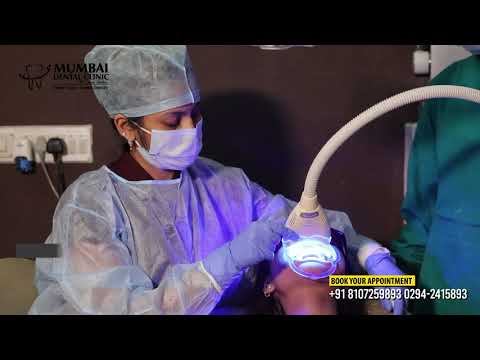 Teeth Whitening In Udaipur | Dr. Mahak Jain | Mumbai Dental Clinic : Udaipur |
