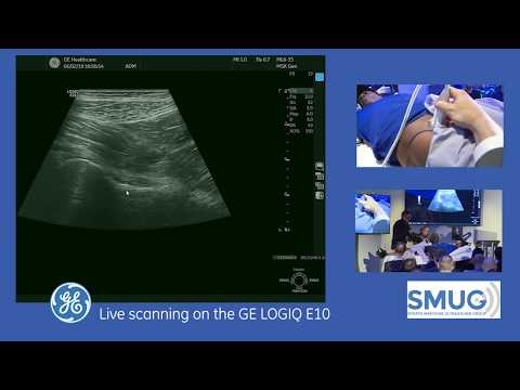 SMUG Jon Jacobson Masterclass 2019.  Hip and Groin Demonstration