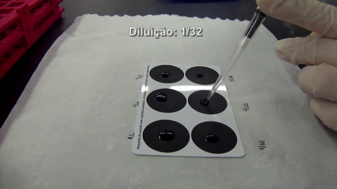 UniRitter_ACIII: Fator Reumatóide