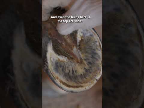 Fixing Severe Hoof Contraction