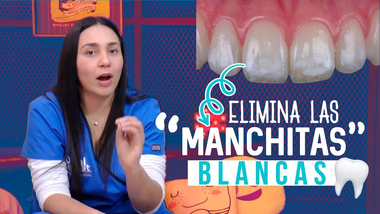 Watch Manchas Blancas en los Dientes- ¡Como QUITARLAS! 👌 Now Manchas Blancas en los Dientes- ¡Como QUITARLAS! 👌