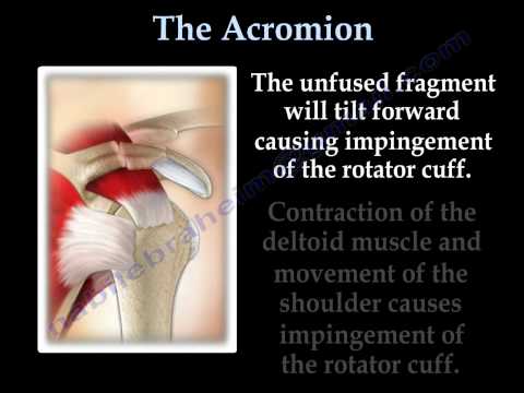 Artroza articulației cheie