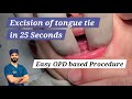 Tongue Tie Excision Dr Tayyab Riaz Ch