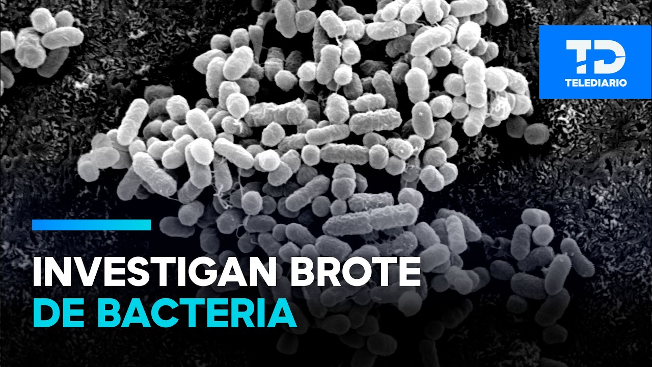 Investigan un posible brote bacteriano en el Centro Médico del IMSS en Jalisco