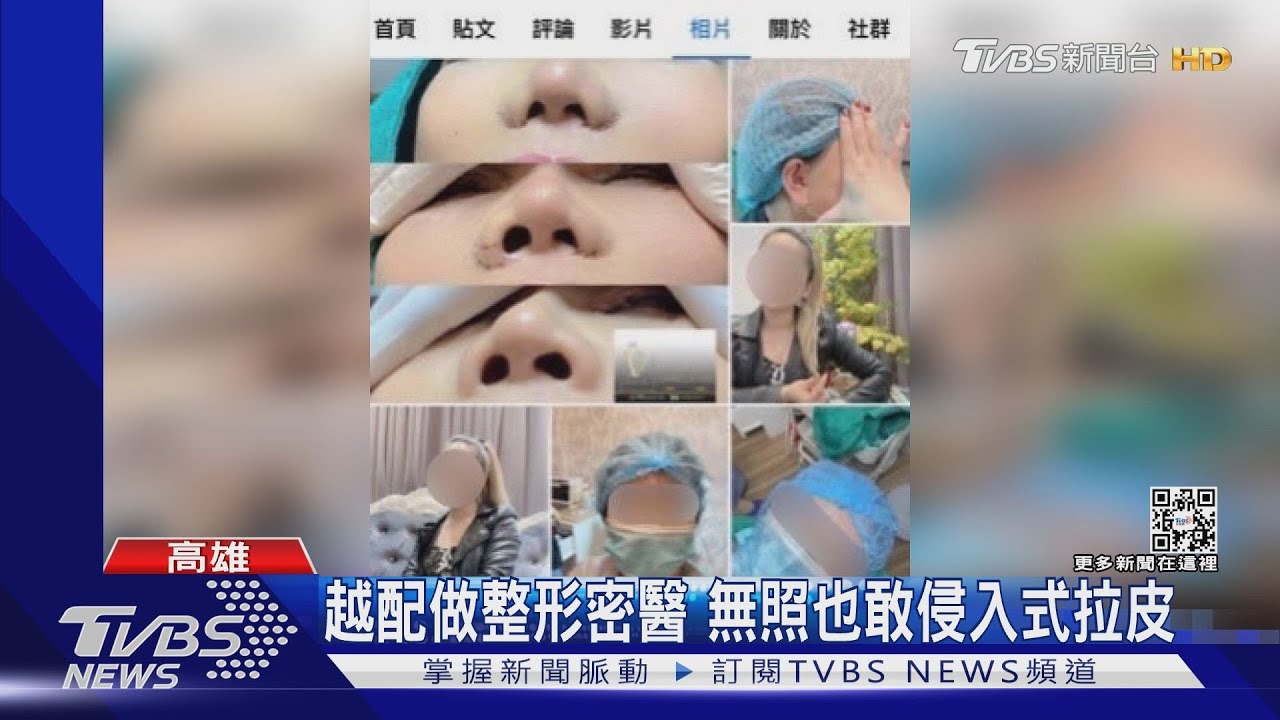 預約滿滿!越配做整形密醫 無照也敢做侵入式拉皮