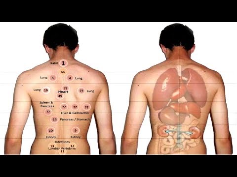 cupping for enlarged prostate