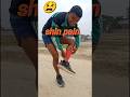 How To Cure Shin Pain सीन पेन कैसे ठीक करें Shorts Shinpain Kartik