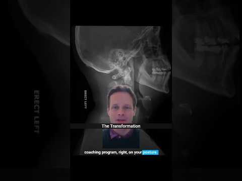 No In-Person Visits. Just Remote Coaching. Here's What Changed (Kevin's story pt. 3) #shorts