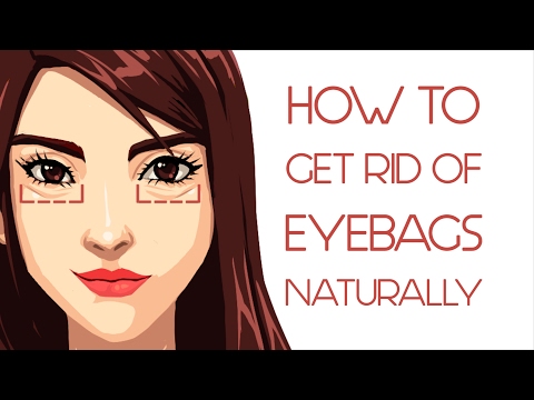 What Your Eye Bags Tell You About Your Health
