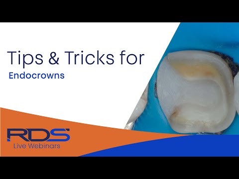 Tips and tricks for Endo-crowns