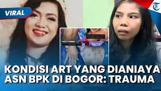 Trauma Berat! Begini Kondisi ART yang Dianiaya ASN BPK Olfit di Bogor: Pemulihan Luka Sekujur Tubuh